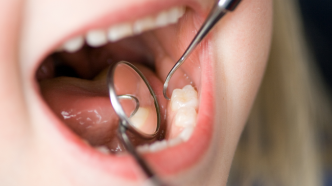 dentistanene